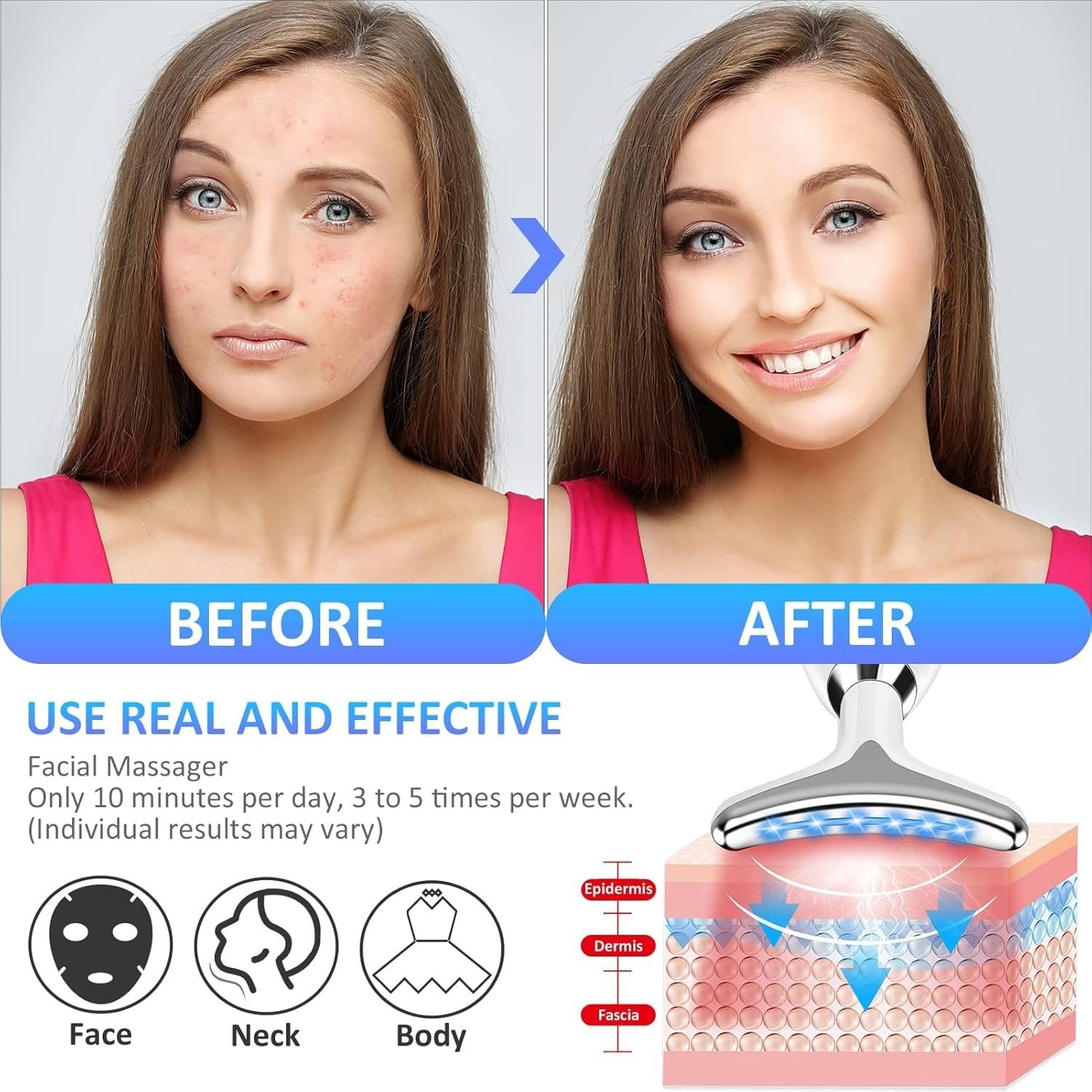 ES-1081 Massager Intense Pulsed Light Wrinkles Reducing Instrument - ESX - Anti Ageing & Reduces Puffiness | Face Massager For Fine Line & Wrinkles - Random Color - Image 8